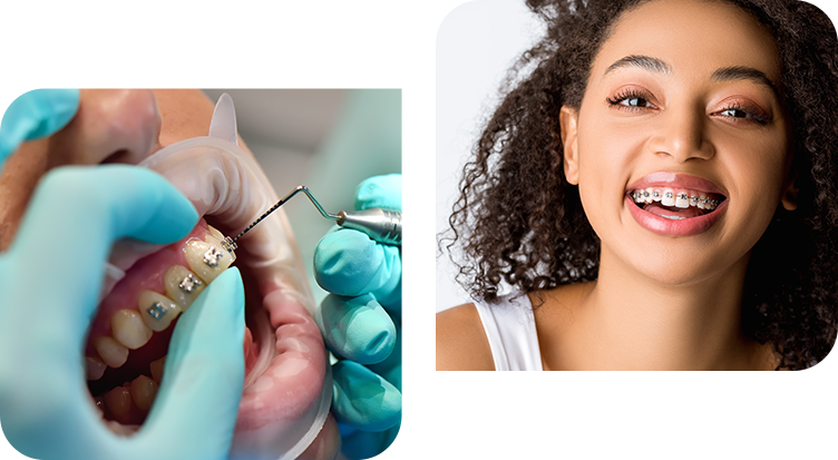 Fixed Braces London – About Us