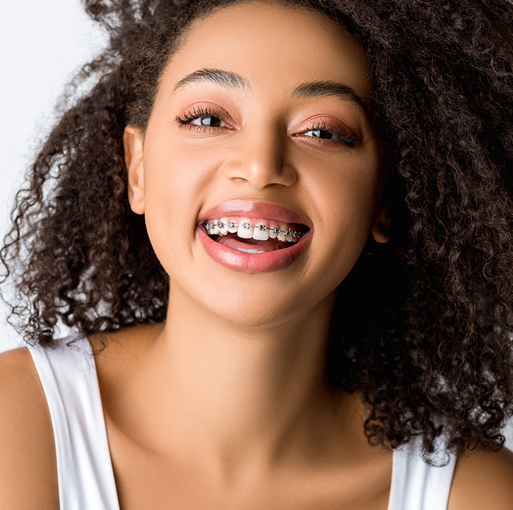 Closing gaps and Improving Smiles – Fixed Braces London