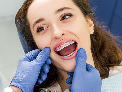 Fixed Braces London – Clinical Brilliance